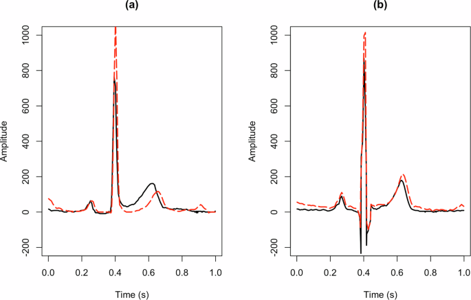 Functional feature extraction and validation from twelve-lead ...