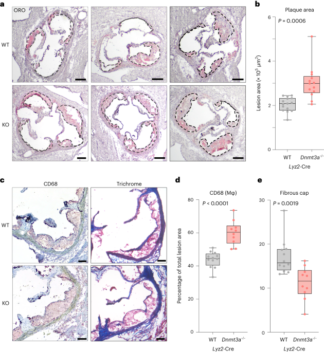 Loss-of-function mutations in dnmt3a and tet2 lead to accelerated atherosclerosis and concordant macrophage phenotypes