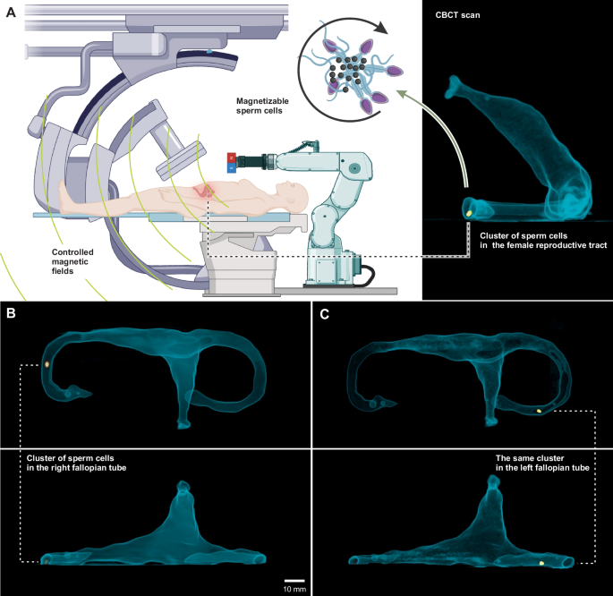 [爆卦] 用精子機器人治療子宮疾病