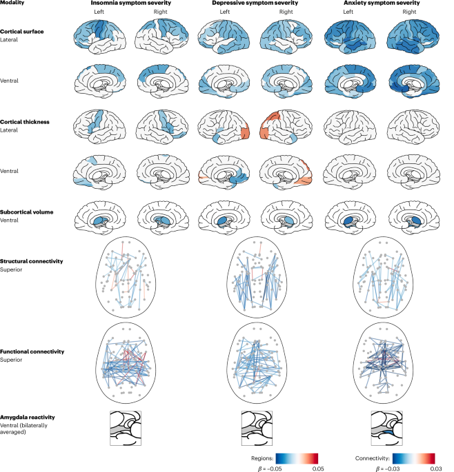 Multimodal brain imaging of insomnia, depression and anxiety symptoms indicates transdiagnostic commonalities and differences