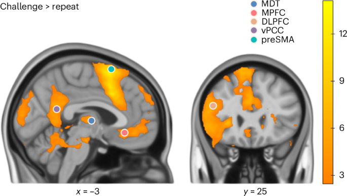 Cognitive restructuring and thalamocortical circuit alterations in post-traumatic stress disorder - Nature Mental Health