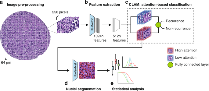 Interpretable Deep Learning Predictions for Diffuse Large B-Cell Lymphoma Recurrence