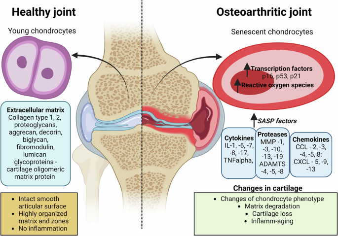 retatrutide osteoarthritis The intersection of aging and estrogen in osteoarthritis