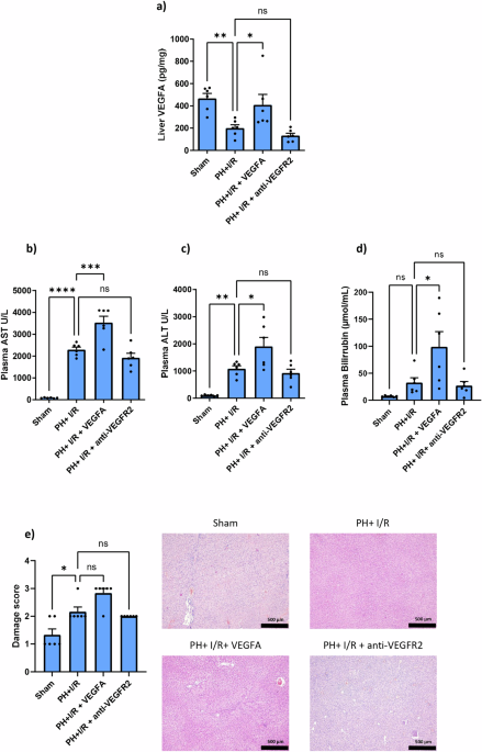 Role of vegfa in type 2 diabetes mellitus rats subjected to partial hepatectomy