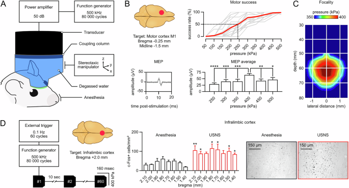 Sound as Medicine: Ultrasound Neurostimulation Opens New Frontiers in Depression Treatment