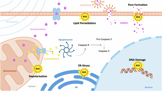 Sonodynamic Therapy and Glioblastoma: Acoustics at the Edge of Cancer Treatment