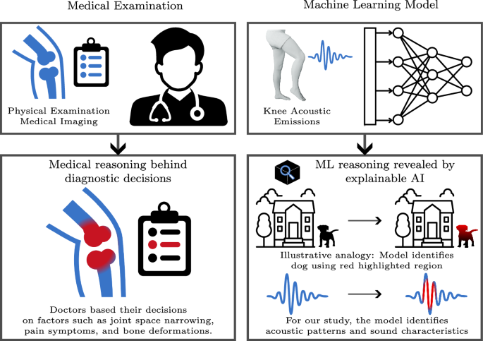 A robust and interpretable deep transfer learning framework on knee acoustic emissions for osteoarthritis classification
