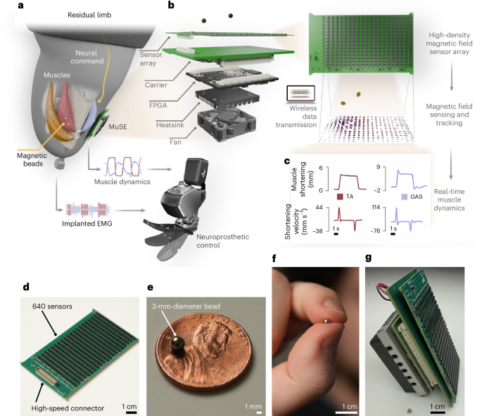 A wireless magnetic implant system for continuous neuromuscular sensing - Nature Sensors