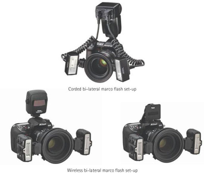 Amazon.com : Godox MF-R76 Macro Ring Flash for Sony, for Canon, for Nikon,  for Fuji Camera : Electronics
