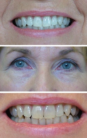 Minocycline Staining British Dental Journal