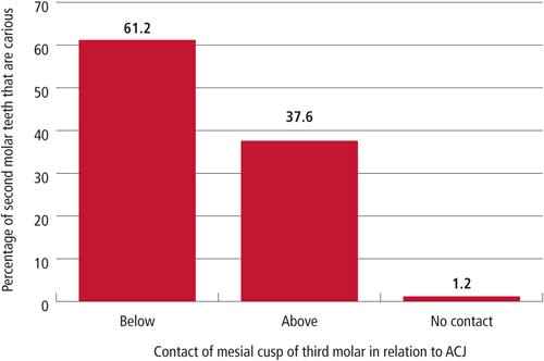 Mean scores for dental caries in the mandibu- lar molars of each group.