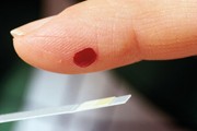 Detecting diabetes at the dental practice