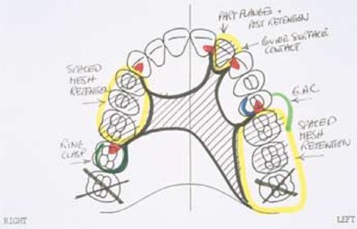 Communication between the dentist and the dental technician