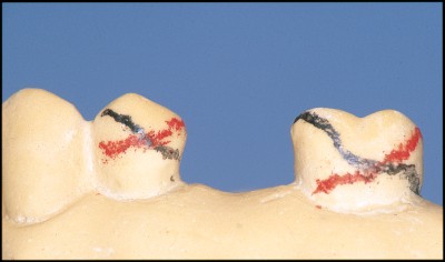 Surveying British Dental Journal - figure28