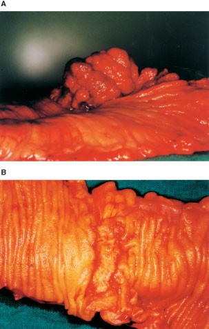 feature-image