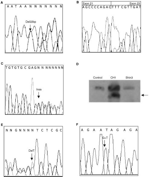 Mutation analysis of cbp and pcaf reveals rare inactivating mutations in cancer cell lines but not in primary tumours