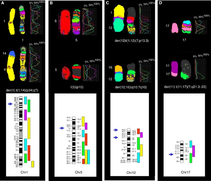 Multicolour-banding fluorescence in situ hybridisation (mbanding-FISH) to  identify recurrent chromosomal alterations in breast tumour cell lines |  British Journal of Cancer
