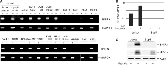 Aberrant DNA methylation associated with silencing BNIP3 gene expression in haematopoietic tumours