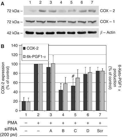 RNA interference as a key to knockdown overexpressed cyclooxygenase-2 gene  in tumour cells | British Journal of Cancer
