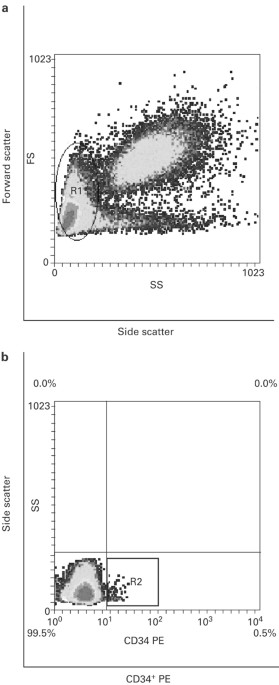 Impaired bone marrow hematopoietic progenitor cell function in rheumatoid arthritis patients candidated to autologous hematopoietic stem cell transpla