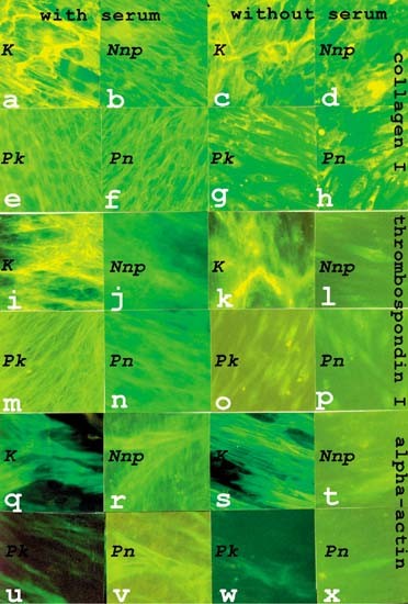 Myofibroblast phenotype and apoptosis in keloid and palmar fibroblasts in vitro