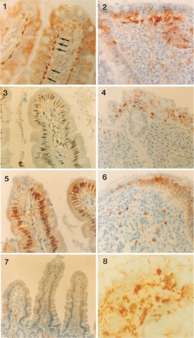 Presence of anti-‘tissue’ transglutaminase antibodies in inflammatory intestinal diseases: an apoptosis-associated event?