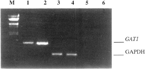 Γ-aminobutyric acid transporter (gat1) overexpression in mouse affects the testicular morphology