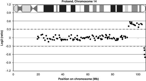 Ring chromosome 15 (a) found in an infant with 