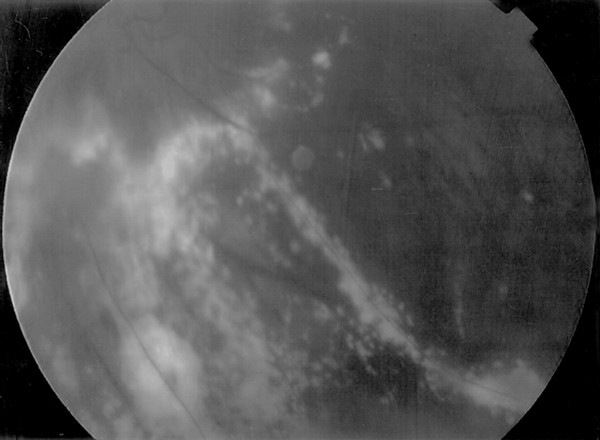 feature-image