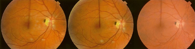 Viagra or What? | Eye