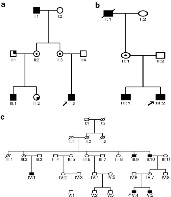 Blue cone monochromatism: a phenotype and genotype assessment with evidence of progressive loss of cone function in older individuals