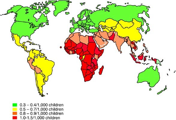 Changing challenges in the control of blindness in children