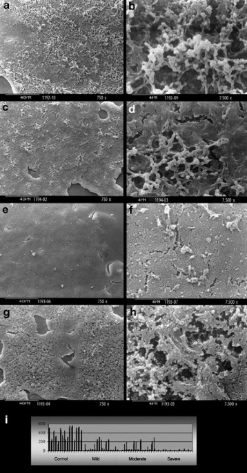 The Microscopic Structures of Dried Human Tears, Science