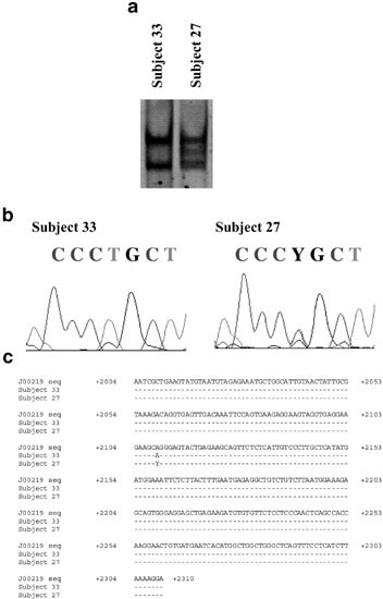 Description of three new polymorphisms in the intronic and 3′utr regions of the human interferon gamma gene