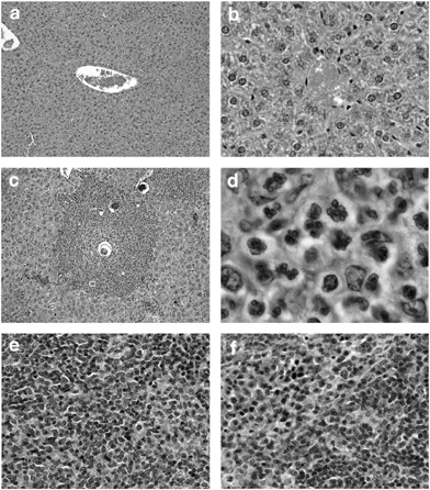 Characterization of the divergent eosinophil ribonuclease, mear 6, and its expression in response to schistosoma mansoni infection in vivo