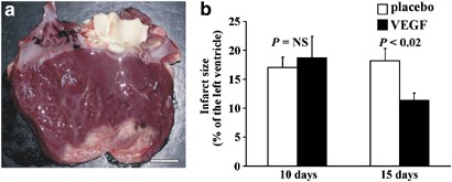 Plasmid-mediated vegf gene transfer induces cardiomyogenesis and reduces myocardial infarct size in sheep