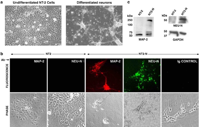 Antioxidant enzyme gene delivery to protect from hiv-1 gp120-induced neuronal apoptosis