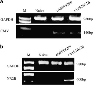 Prevention of neuropathic pain in an animal model of spare nerve injury following oral immunization with recombinant adenovirus serotype 5-mediated nr