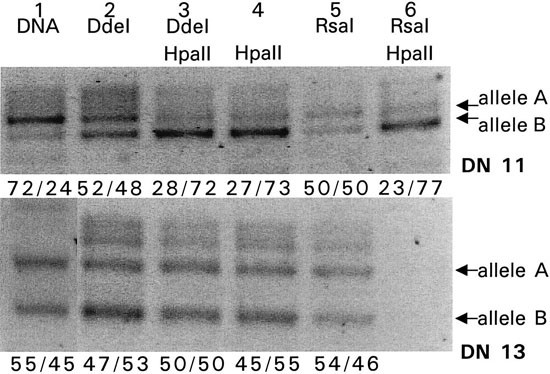Acquired skewing of lyonization remains stable for a prolonged period in healthy blood donors