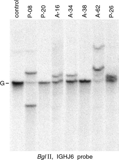 Fusion gene transcripts and ig/tcr gene rearrangements are complementary but infrequent targets for pcr-based detection of minimal residual disease in acute myeloid leukemia
