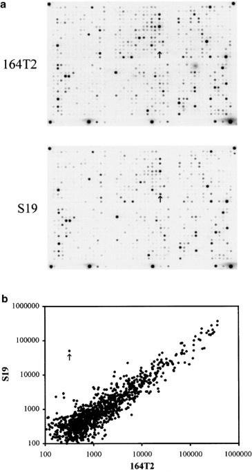 Upregulation of galectin-7 in murine lymphoma cells is associated with progression toward an aggressive phenotype