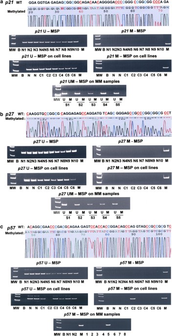 Infrequent epigenetic dysregulation of cip/kip family of cyclin-dependent kinase inhibitors in multiple myeloma
