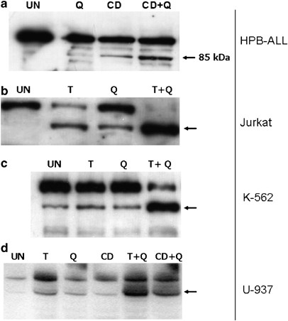 Quercetin Enhances Cd95 And Trail Induced Apoptosis In Leukemia Cell Lines Leukemia