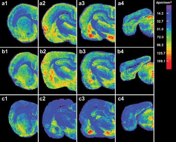 Increased Anxiety 3 Months after Brief Exposure to MDMA ('Ecstasy') in  Rats: Association with Altered 5-HT Transporter and Receptor Density |  Neuropsychopharmacology