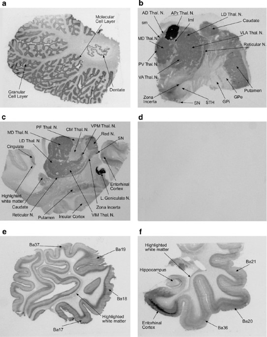 Personalized genetics of the cholinergic blockade of neuroinflammation -  Simchovitz - 2017 - Journal of Neurochemistry - Wiley Online Library