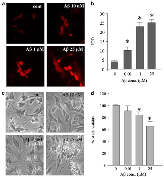 Blockade of the tumor necrosis factor-related apoptosis inducing ligand death receptor dr5 prevents β-amyloid neurotoxicity