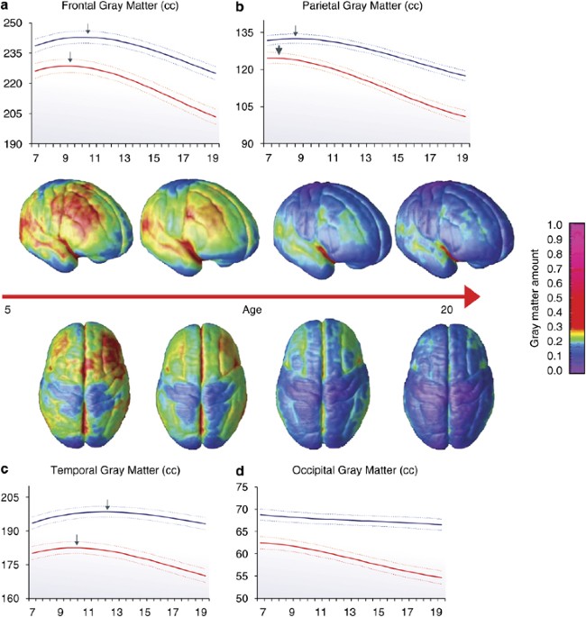Brain Neuroplasticity in Healthy, Hyperactive and Psychotic Children:  Insights from Neuroimaging | Neuropsychopharmacology