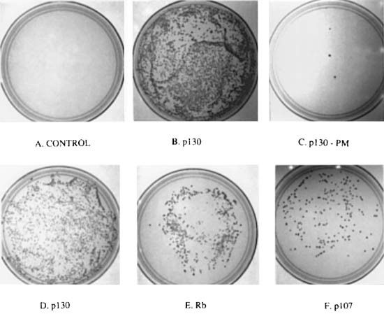 Prohibitin, a potential tumor suppressor, interacts with rb and regulates e2f function