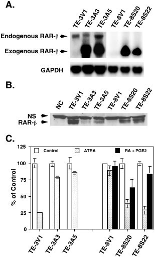 Induction Of Retinoic Acid Receptor B Suppresses Cyclooxygenase 2 Expression In Esophageal Cancer Cells Oncogene
