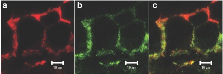 Connexin 43, but not connexin 32, is mutated at advanced stages of human sporadic colon cancer